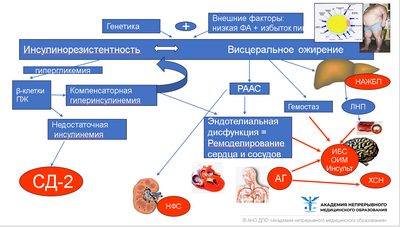 Ожирение может повысить риск развития A-фиброза Ожирение может повысить риск развития A-фиброза